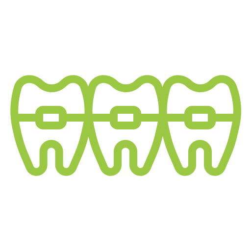 Ceramic Braces