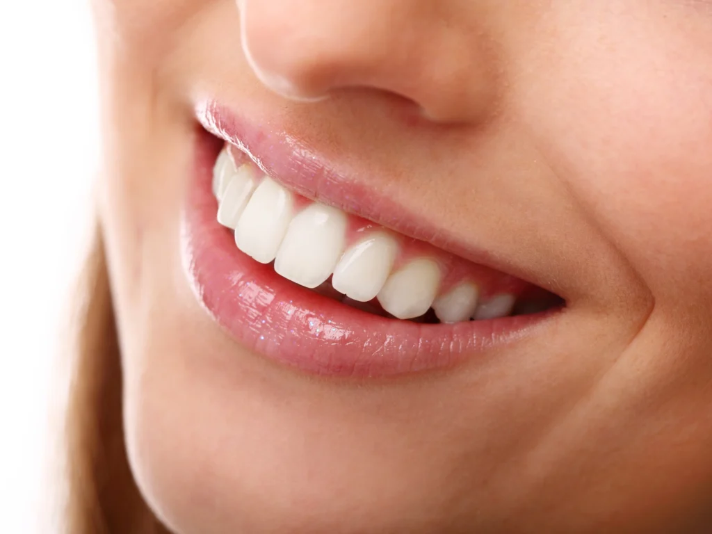 Combined Whitening (In-Office + Take-Home)