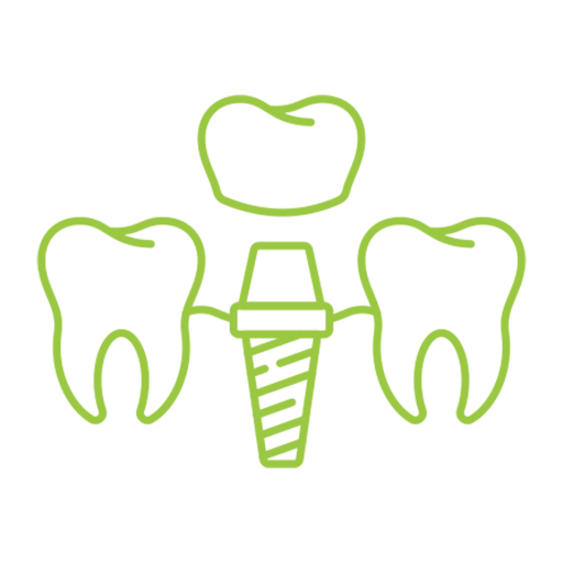 Immediate Loading Dental Implants