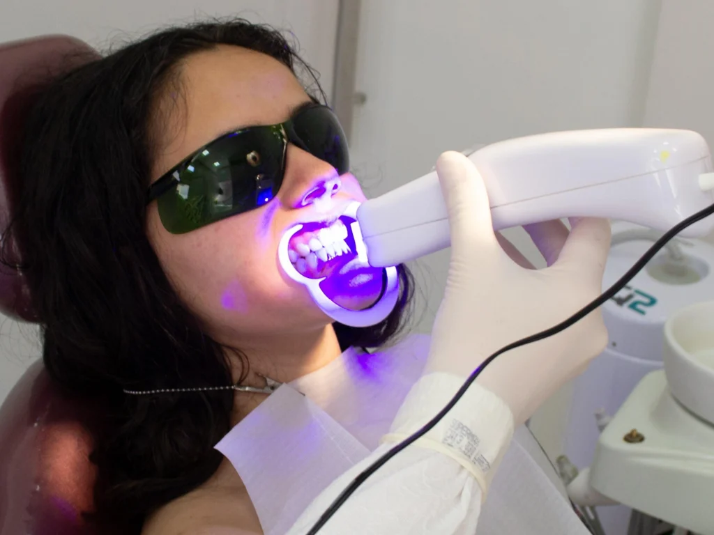 In-office professional teeth whitening