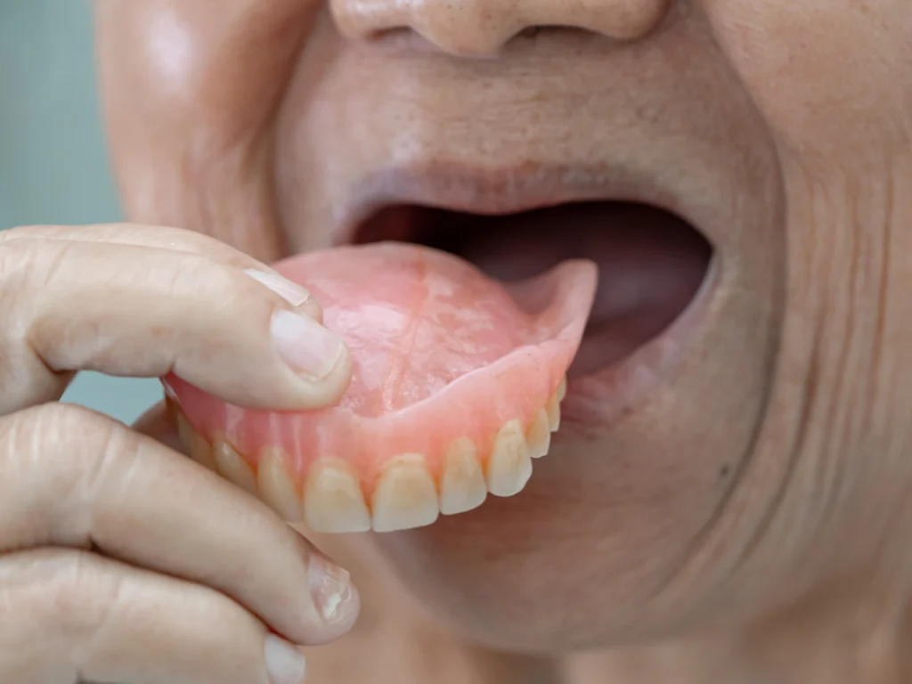 Loose, Slipping, or Uncomfortable Dentures