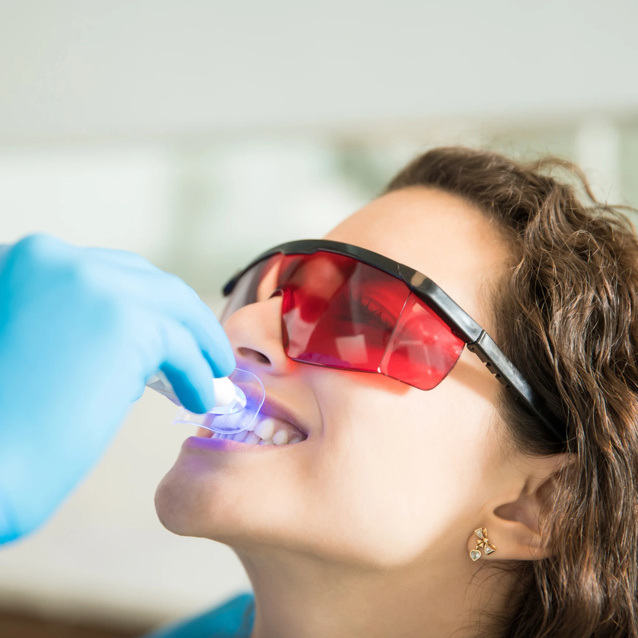 What is Professional Teeth Whitening Treatment