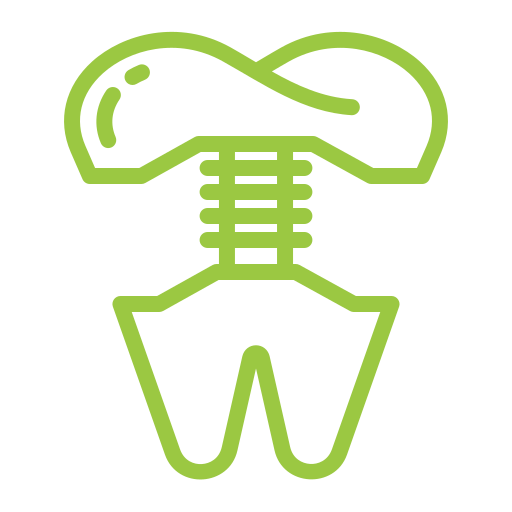 Zygomatic Implants