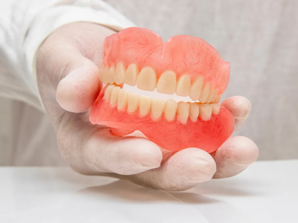 Complete Dentures