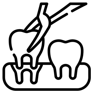 Extraction under expert care