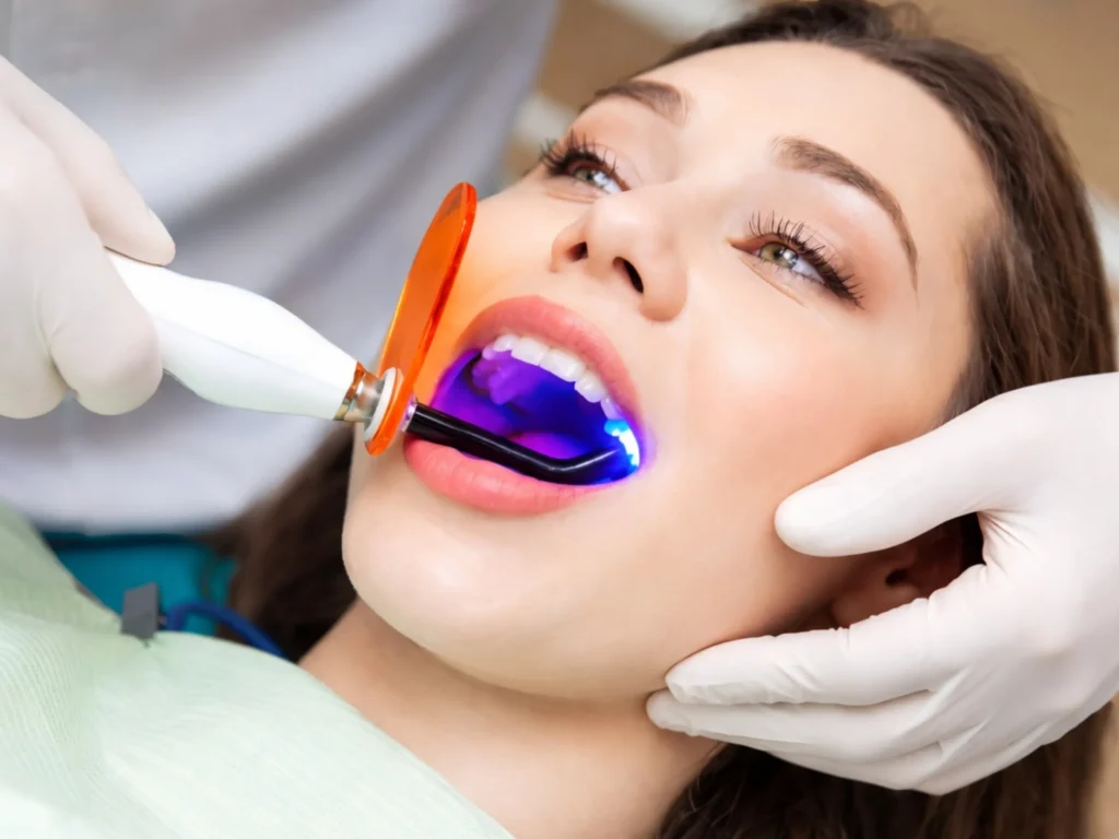 Laser Root Canal Treatment (1)