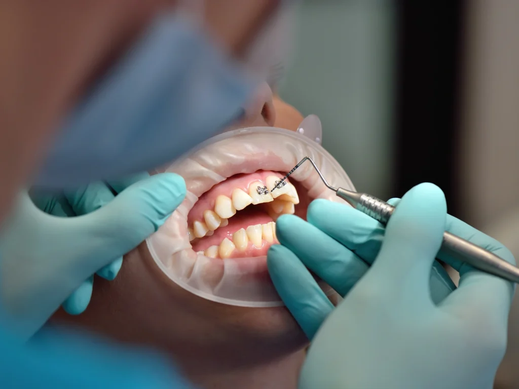 Soft Tissue Impact Removal
