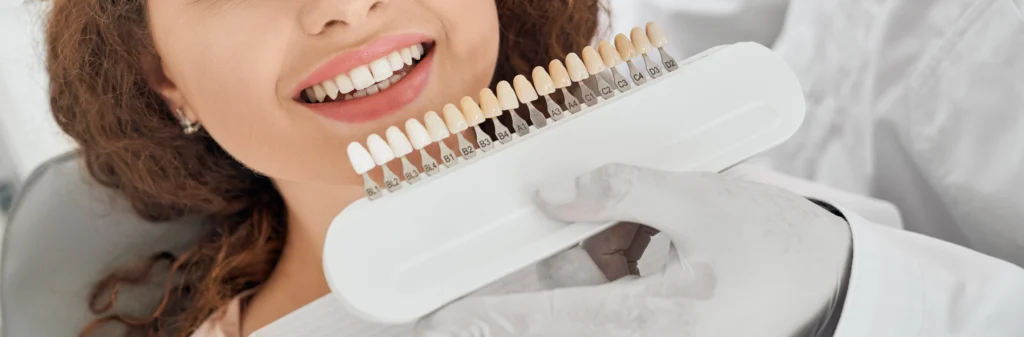 Teeth Whitening Procedure What to Expect at the Clinic