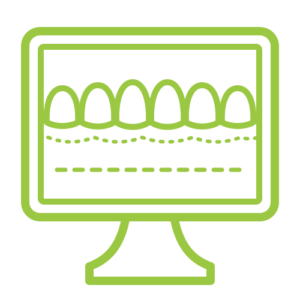 Digital Smile Design