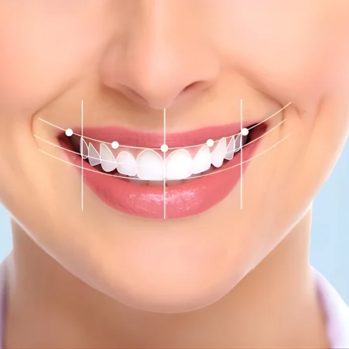 Digital Smile Design