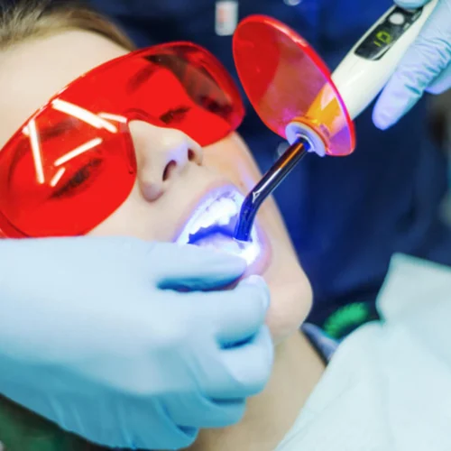 Laser Dentistry