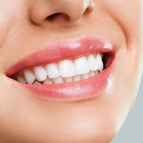 Teeth Whitening