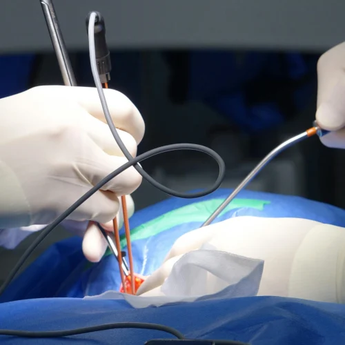 Minimally Invasive Procedures